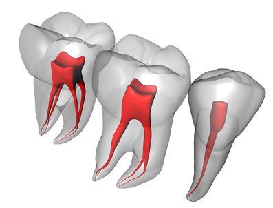 Ενδοδοντία - Δόντια Εσωτερικά