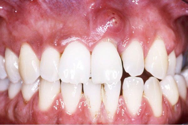 Ενδοδοντολόγος Θεσσαλονίκη Ενδοδοντολόγος Θεσσαλονίκη