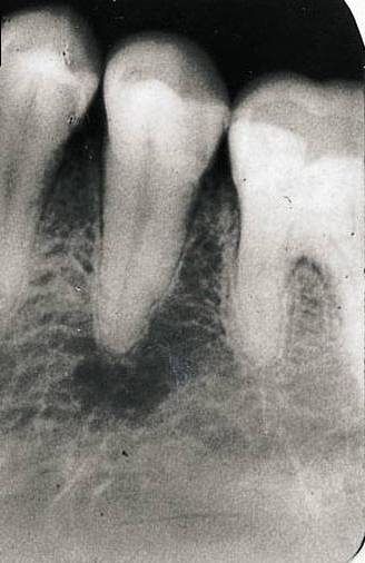 Ενδοδοντολόγος Θεσσαλονίκη Ενδοδοντολόγος Θεσσαλονίκη