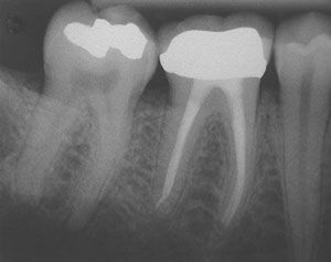 Ενδοδοντολόγος Θεσσαλονίκη