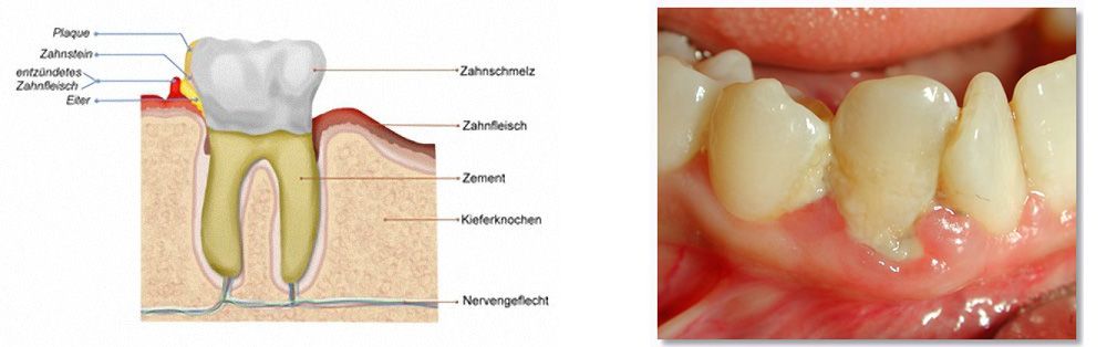 Ενδοδοντιστής Θεσσαλονίκη Ενδοδοντιστής Θεσσαλονίκη