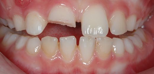 Ενδοδοντιστής Θέρμη Ενδοδοντιστής Θέρμη