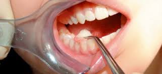 παιδοδοντιατρος θεσσαλονικη παιδοδοντίατρος θεσσαλονικη